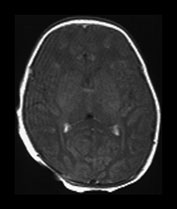 Fig. 6.1 (b)