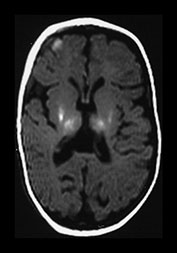 Fig. 6.3 (diii)