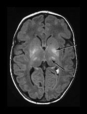 Fig. 6.6 (bii)