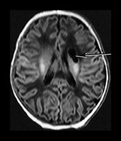 Fig. 7.1 (a) Fig. 7.1 (a)