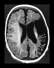 Fig. 7.1 (b) Fig. 7.1 (b)