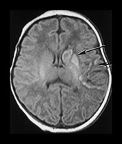 Fig. 7.1 (c) Fig. 7.1 (c)