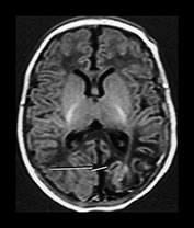 Fig. 7.1 (d) Fig. 7.1 (d)