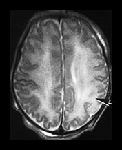 Fig. 7.2 (a) Fig. 7.2 (a)