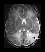 Fig. 7.2 (b) Fig. 7.2 (b)