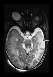Fig. 7.2 (c) Fig. 7.2 (c)
