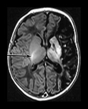 Fig. 7.3 Fig. 7.3
