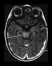 Fig. 7.4 Fig. 7.4