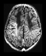 Fig. 7.5 (a) Fig. 7.5 (a)