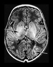 Fig. 7.5 (b) Fig. 7.5 (b)