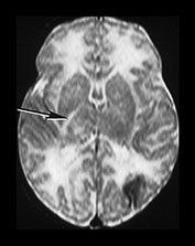 Fig. 7.5 (c) Fig. 7.5 (c)