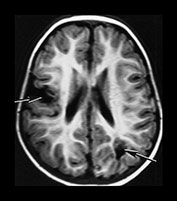 Fig. 7.5 (d) Fig. 7.5 (d)