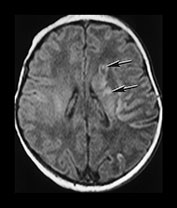 Fig. 7.6 (a) Fig. 7.6 (a)
