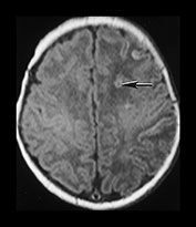 Fig. 7.6 (b) Fig. 7.6 (b)