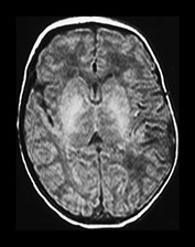 Fig. 7.7 (a) Fig. 7.7 (a)
