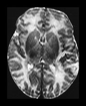Fig. 7.7 (b) Fig. 7.7 (b)