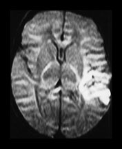 Fig. 7.7 (c) Fig. 7.7 (c)