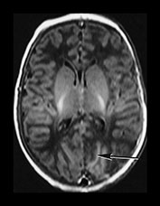 Fig. 7.8 (a) Fig. 7.8 (a)