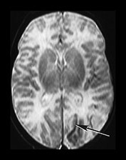 Fig. 7.8 (b) Fig. 7.8 (b)
