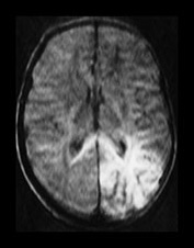 Fig. 7.8 (c) Fig. 7.8 (c)