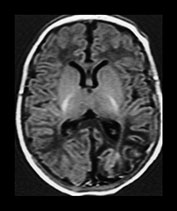 Fig. 7.8 (d) Fig. 7.8 (d)