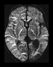 Fig. 7.8 (f) Fig. 7.8 (f)