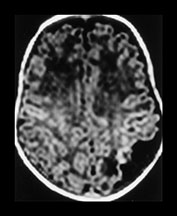 Fig. 7.9 (a) Fig. 7.9 (a)