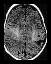 Fig. 7.9 (b) Fig. 7.9 (b)
