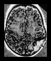 Fig. 7.9 (c) Fig. 7.9 (c)