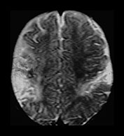 Fig. 7.15 (a) Fig. 7.15a (a)