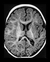 Fig. 7.15 (b) Fig. 7.15b (b)