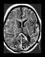 Fig. 7.15 (c) Fig. 7.15c (c)
