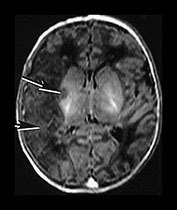 Fig. 7.16 (a) Fig. 7.16 (a)