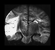 Fig. 7.16 (b) Fig. 7.16 (b)