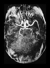 Fig. 7.16 (c) Fig. 7.16 (c)
