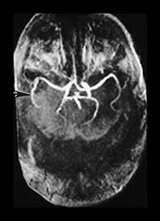 Fig. 7.16 (d) Fig. 7.16 (d)
