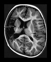 Fig. 7.16 (e) Fig. 7.16 (e)