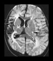 Fig. 7.16 (f) Fig. 7.16 (f)