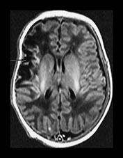 Fig. 7.17 (a) Fig. 7.17 (a)