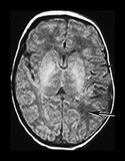 Fig. 7.18 (a) Fig. 7.18a (a)