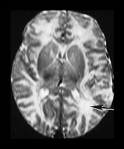 Fig. 7.18 (b) Fig. 7.18b (b)