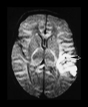 Fig. 7.18 (c) Fig. 7.18c (c)