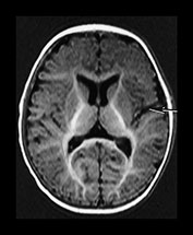 Fig. 7.18 (d) Fig. 7.18 (d)