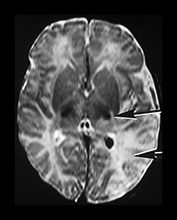 Fig. 7.19 (a) Fig. 7.19 (a)