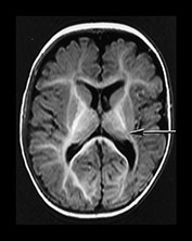 Fig. 7.19 (b) Fig. 7.19 (b)