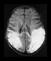 Fig. 7.20 (a) Fig. 7.20 (a)