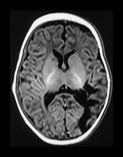 Fig. 7.20 (b) Fig. 7.20 (b)