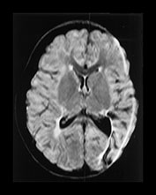 Fig. 7.2c (b) Fig. 7.20 (c)