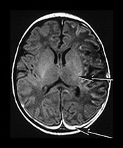 Fig. 7.21 (a) Fig. 7.21 (a)