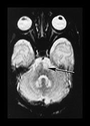 Fig. 7.22 (b) Fig. 7.22 (b)